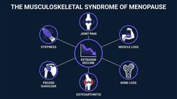 Musculoskeletal Syndrome of Menopause: The Research